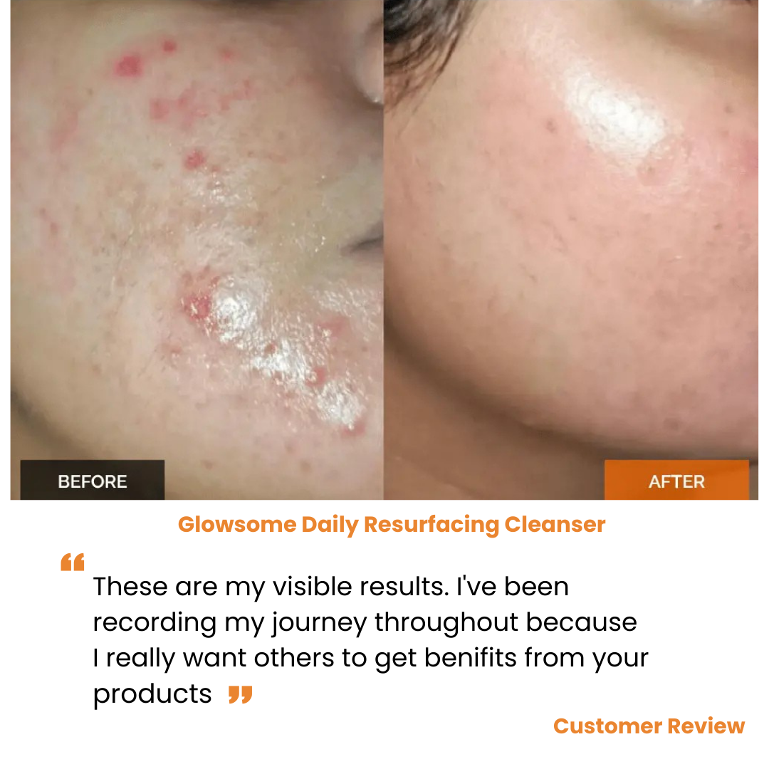 Daily Resurfacing Cleanser - Glowsome