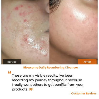 Daily Resurfacing Cleanser - Glowsome